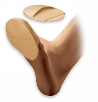 Vorderfuss Abdeckung mit  Silikon-Pad  grandeur L, 1 paire