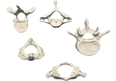 RÜDIGER Atlas und Axis