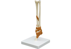 RÜDIGER Funktionsmodell Ellenbogengelenk