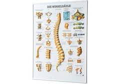 RÜDIGER 3D Relief Poster Wirbelsäule 74 x 54  de