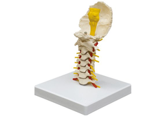 RÜDIGER Halswirbelsäule